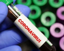 За добу у 586 мешканців Дніпропетровщини виявили COVID-19