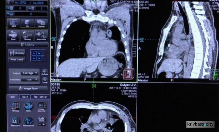 В Криворожском тубдиспансере №2 появился новый томограф (ФОТО)